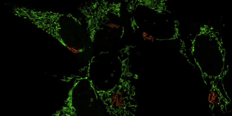 光刺激：数字微镜器件（DMD）